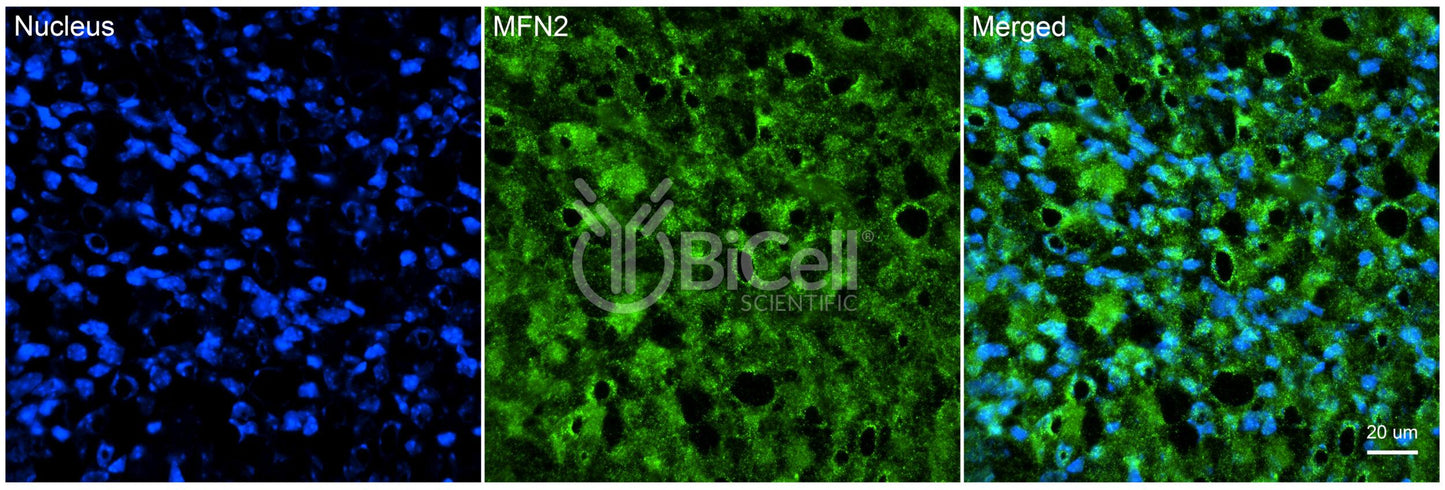 Mitofusin-2 (MFN2) Antibody