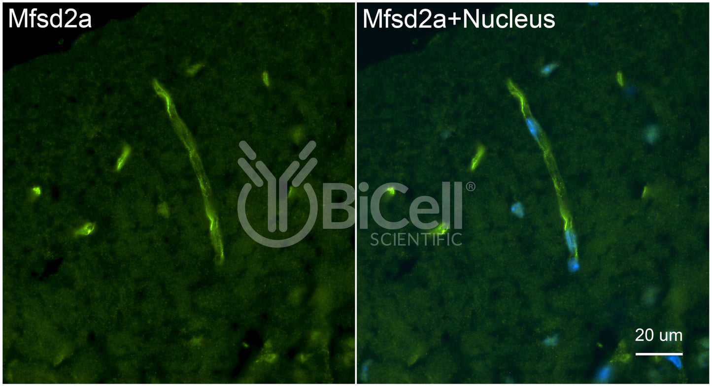 MFSD2A (NLS1) (N-Terminus) (Cytoplasmic) Antibody - FFPE Validated