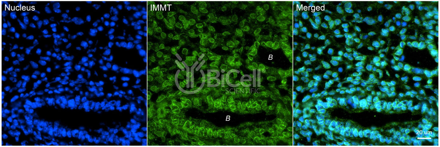 IMMT (Mitofilin or Mic60) Antibody - FFPE Validated