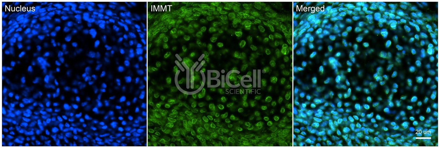 IMMT (Mitofilin or Mic60) Antibody - FFPE Validated