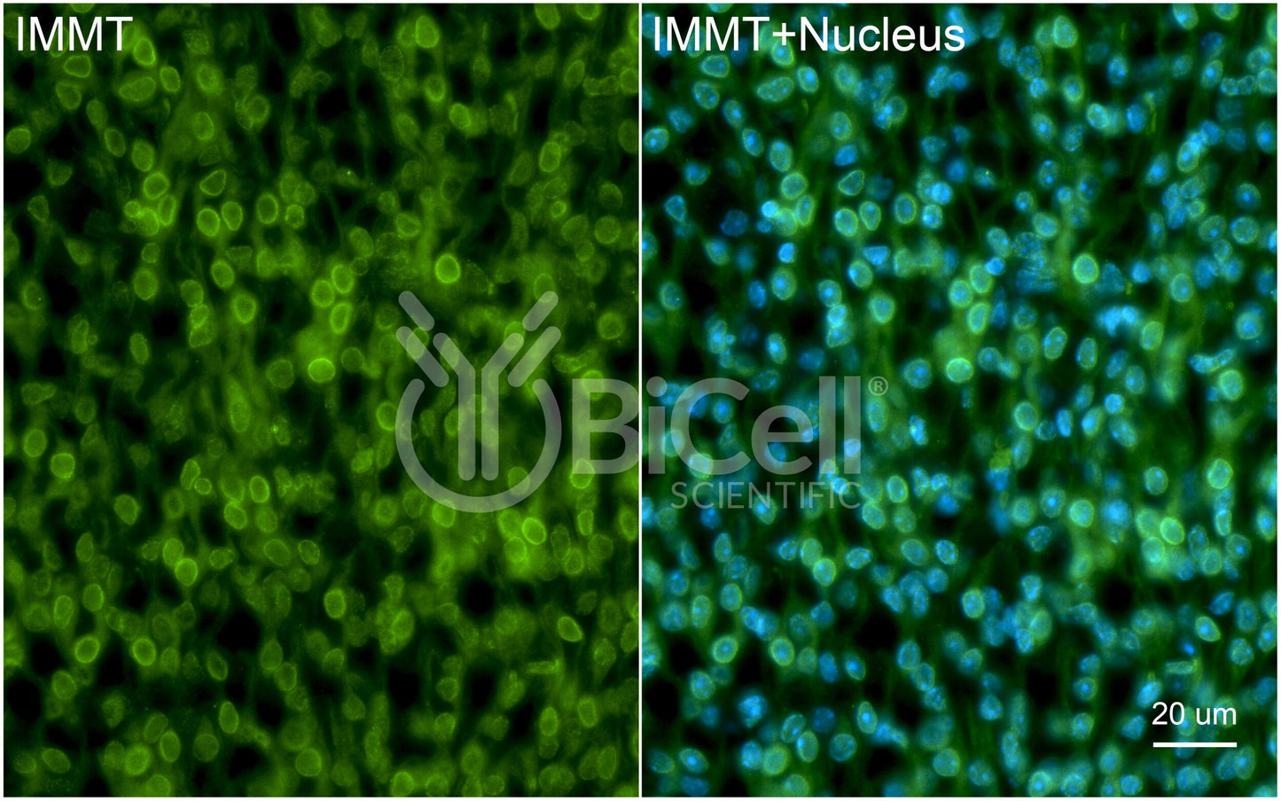 IMMT (Mitofilin or Mic60) Antibody