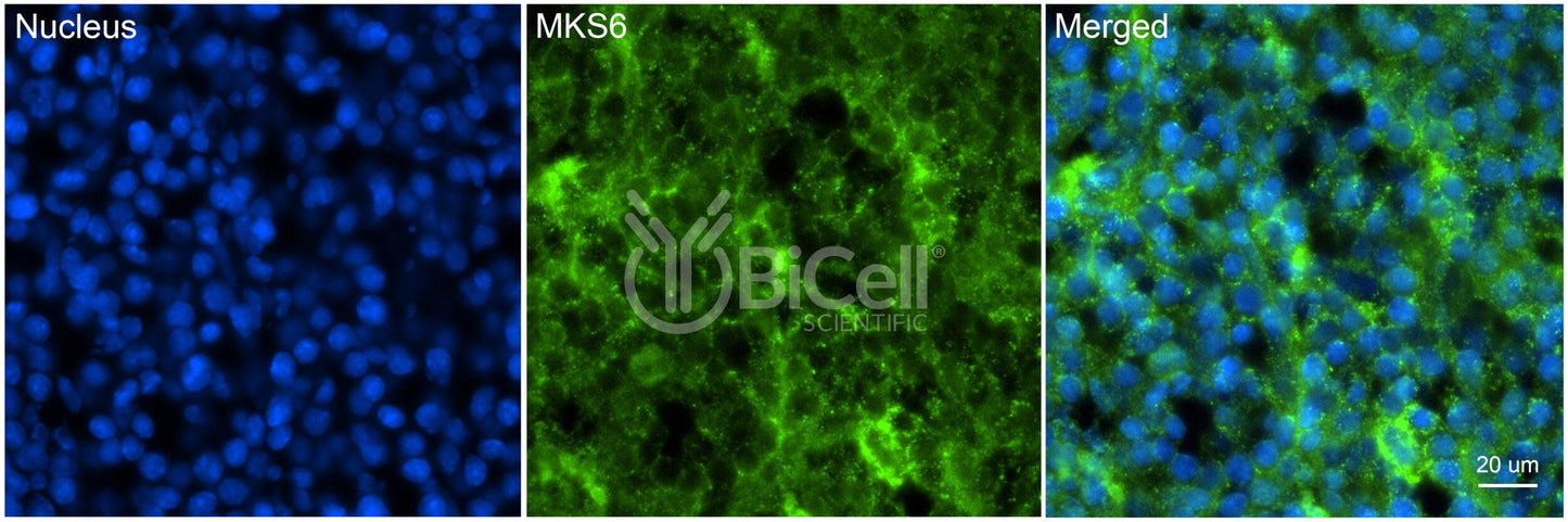 MKS6 (CC2D2A) Antibody - Western Blot Validated