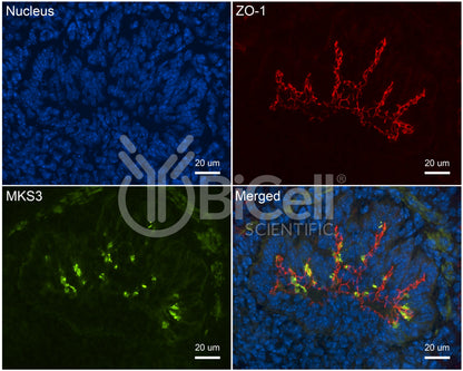 MKS3 (NPHP11 or Meckelin or TMEM67) Antibody - Western Blot Validated
