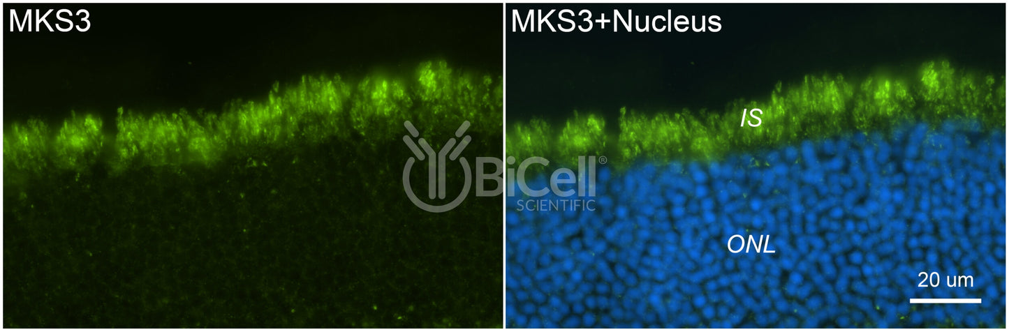 MKS3 (NPHP11 or Meckelin or TMEM67) Antibody - Western Blot Validated
