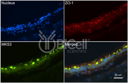 MKS3 (NPHP11 or Meckelin or TMEM67) Antibody - FFPE Validated