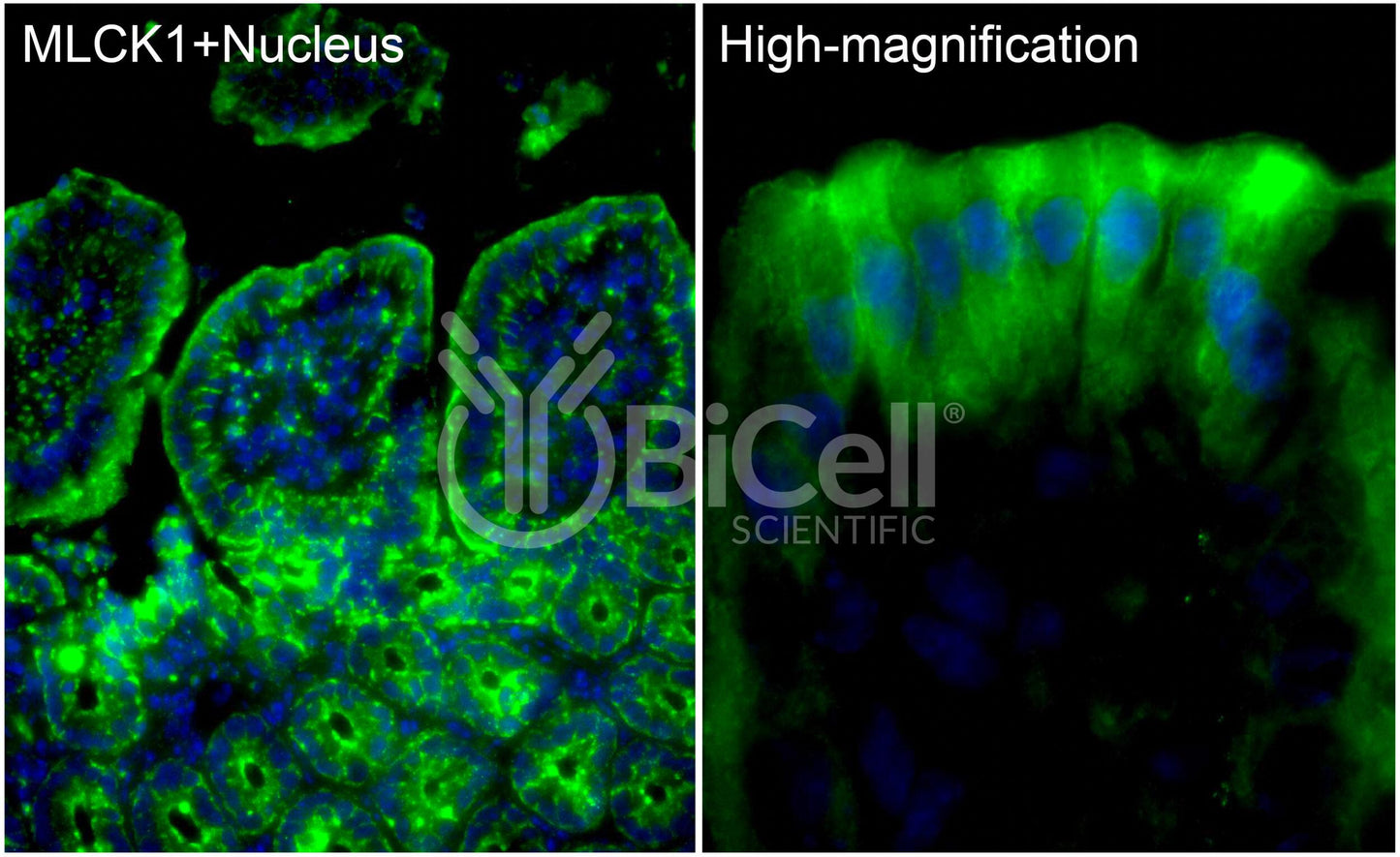 MYLK (MLCK or MLCK1) Antibody - FFPE Validated