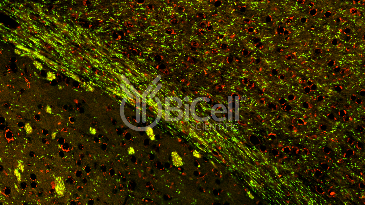 CHRNA1 (ACHRA) Antibody - FFPE Validated