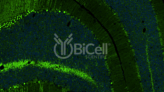Calbindin-1 (CALB1 or Calbindin D-28K) Antibody
