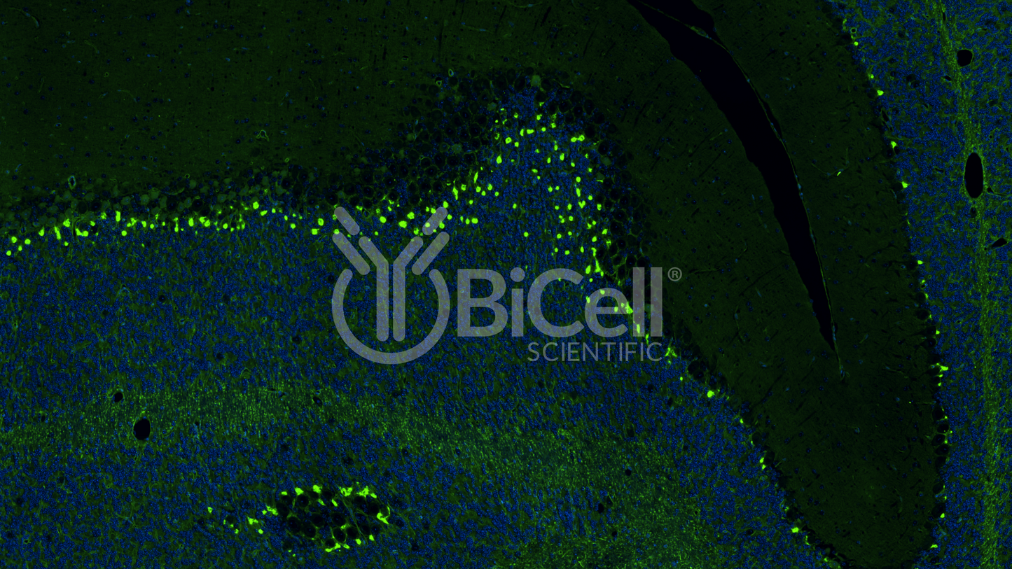 KCNA1 (Kv1.1) Antibody - Western Blot Validated