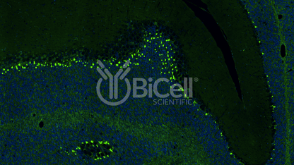 KCNA1 (Kv1.1) Antibody