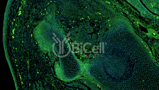 EGFR (ErbB1 or HER1) Antibody - Western Blot Validated