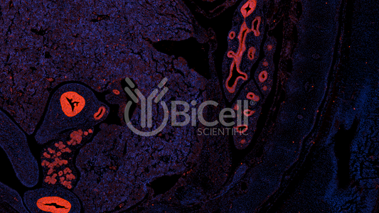 EpCAM (CD326 or 17-1A antigen or TACSTD1) Antibody - FFPE Validated