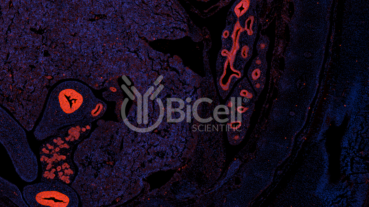 EpCAM (CD326 or 17-1A antigen or TACSTD1) Antibody