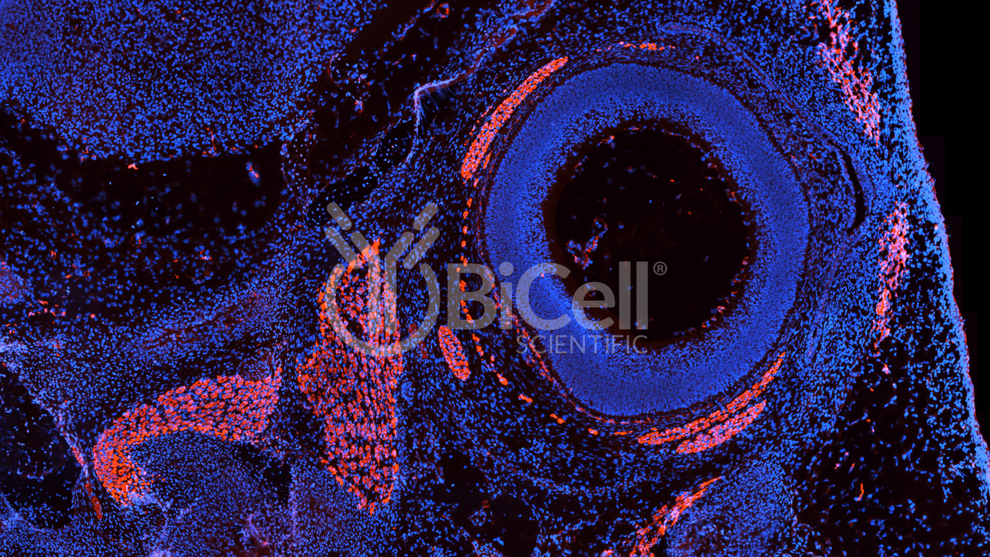 Desmin (DES) Antibody - FFPE Validated