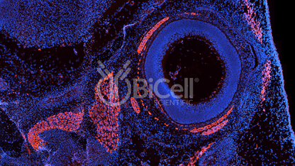Desmin (DES) Antibody - FFPE Validated