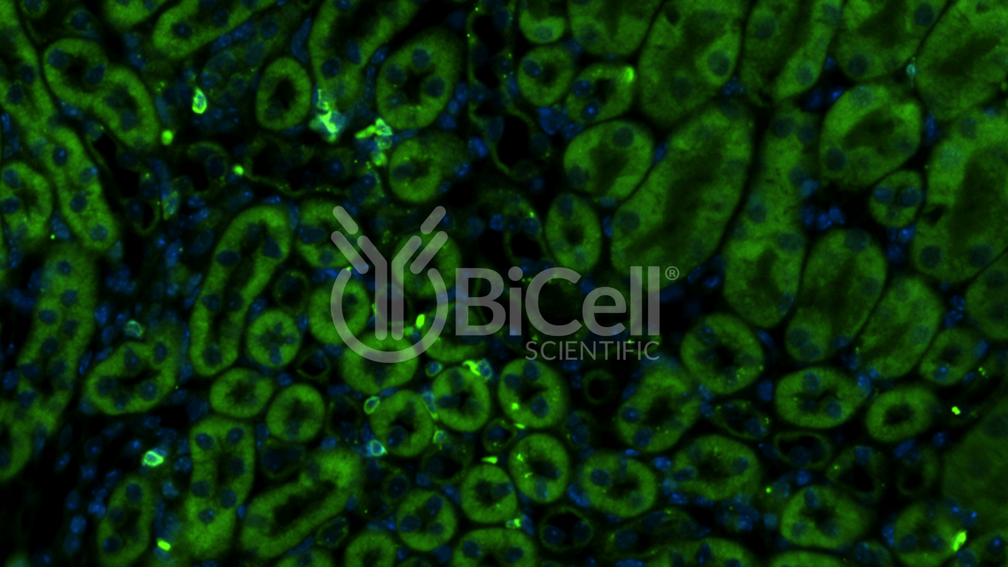 CXCR3 (CD183) Antibody
