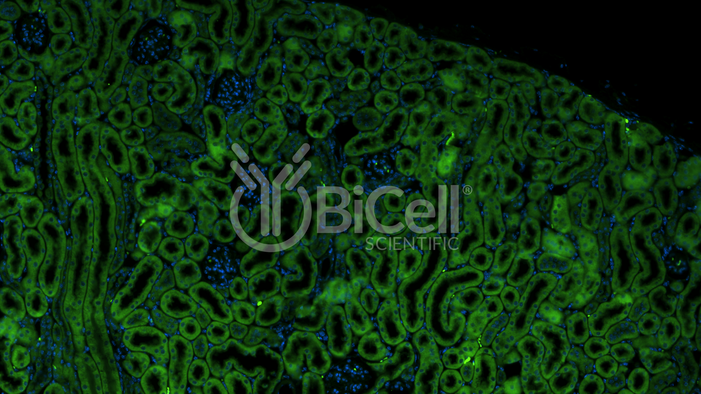 CXCR5 (CD185) Antibody - FFPE Validated