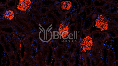 Integrin alpha-3 (ITGA3 or CD49c) Antibody