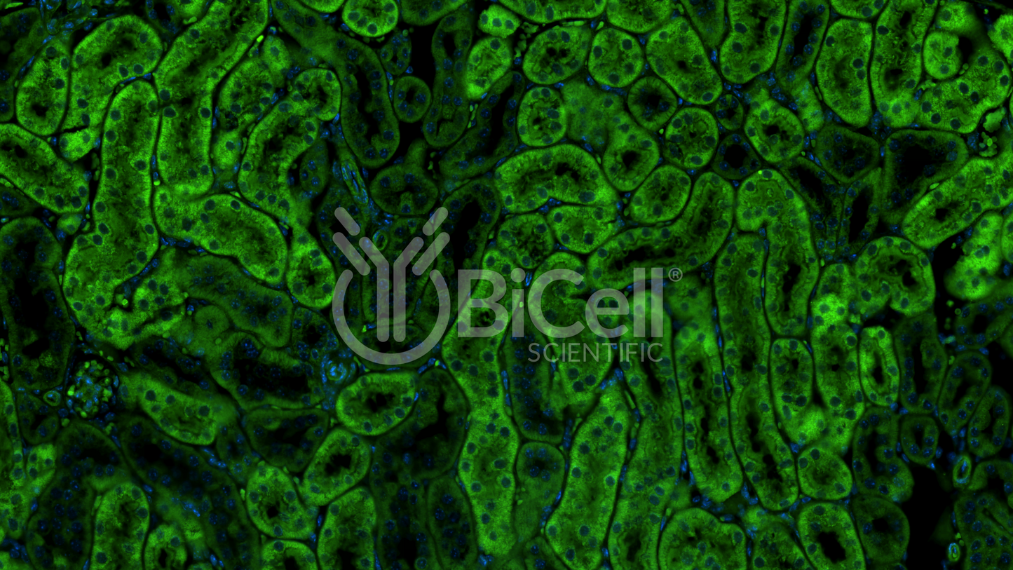 Integrin alpha-E (ITGAE or CD103) Antibody - FFPE Validated