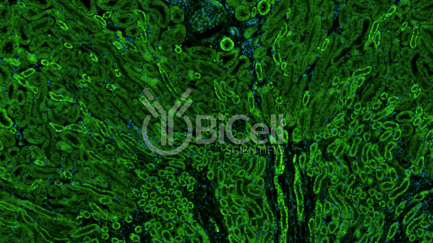 Myosin IE (MYO1E or FSGS6) Antibody - Western Blot Validated