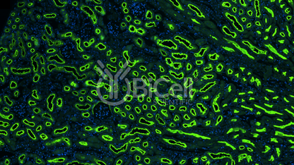 NPT2a (SLC34a1) Antibody