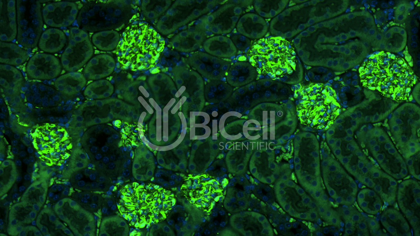 Vimentin (VIM) Antibody