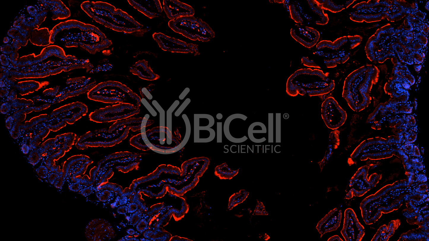 MYLK (MLCK or MLCK1) Antibody - FFPE Validated