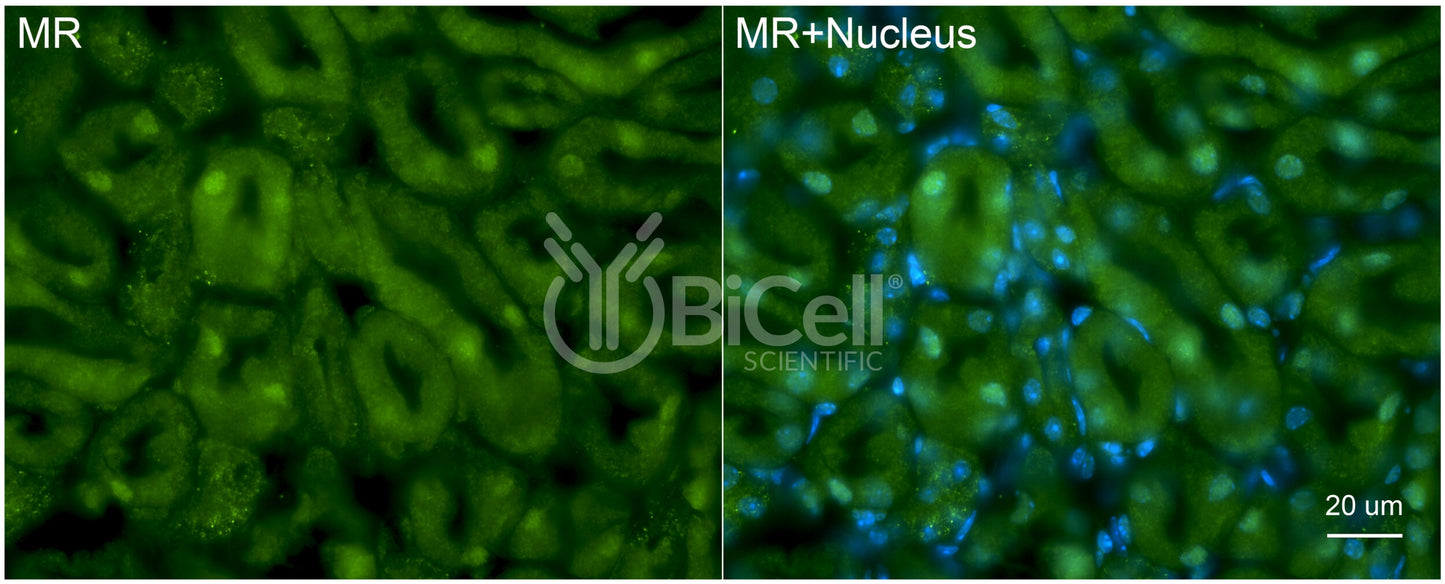 MR (NR3C2) Antibody