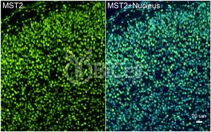 STK3 (MST2) Antibody