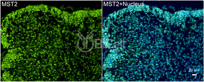 STK3 (MST2) Antibody
