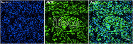 MTOR Antibody - Western Blot Validated