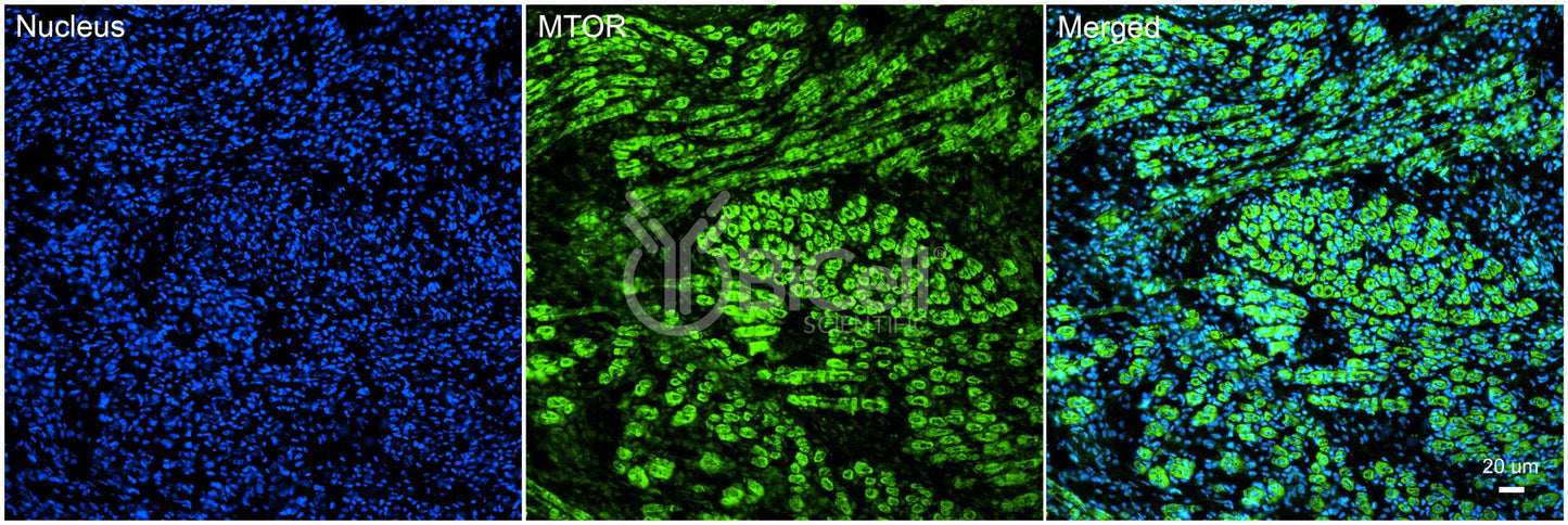 MTOR Antibody - FFPE Validated