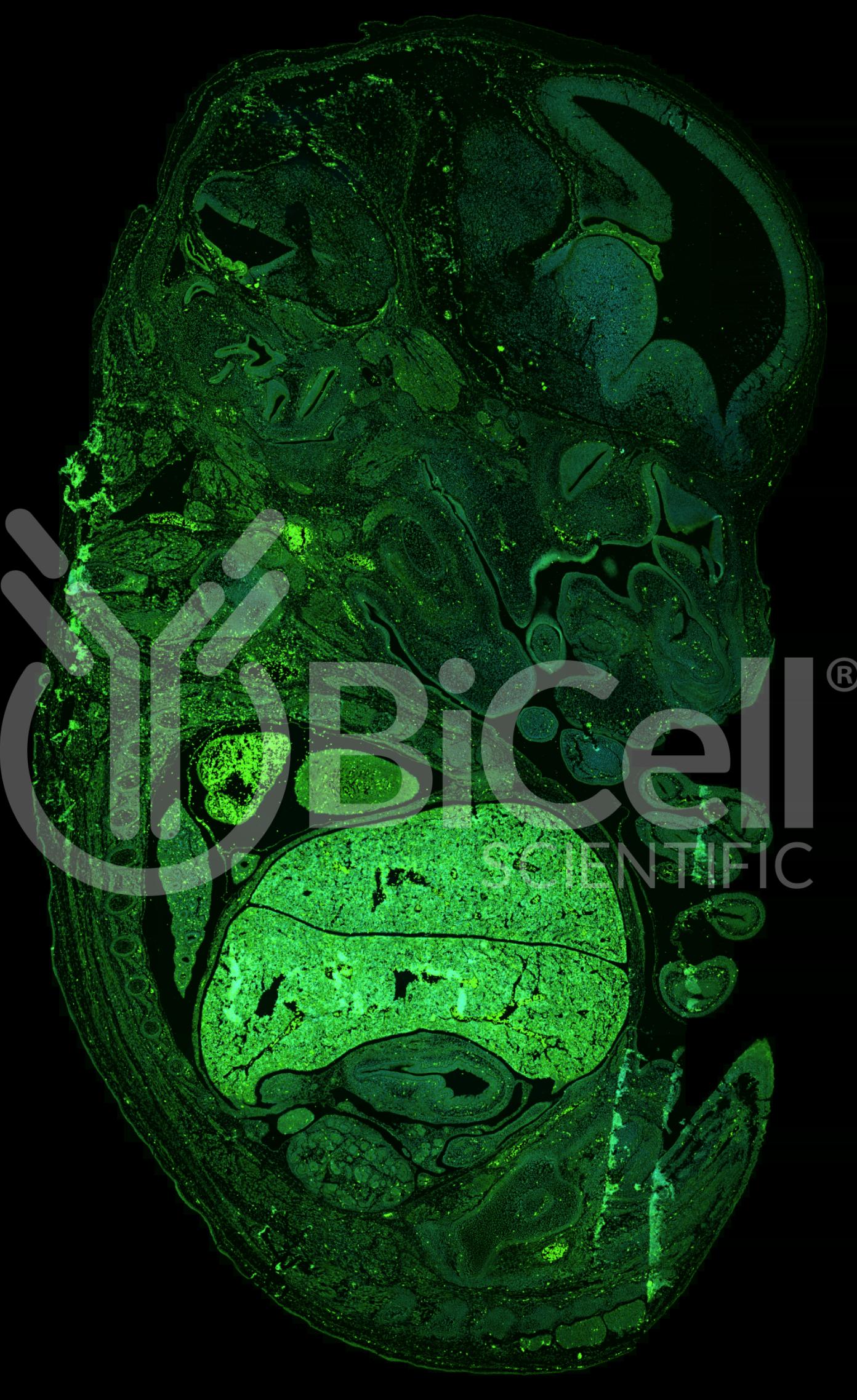 MTOR Antibody - FFPE Validated