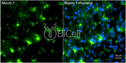 Mucin-1 (MUC1 or CD227) Antibody