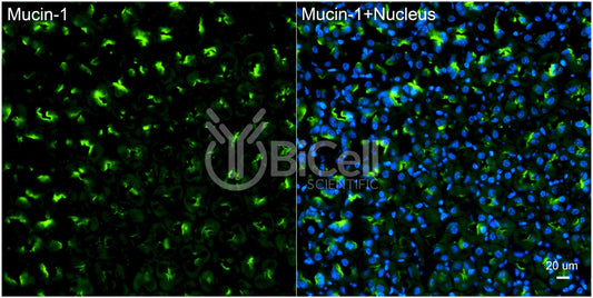 Mucin-1 (MUC1 or CD227) Antibody