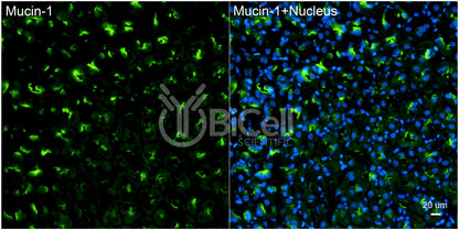 Mucin-1 (MUC1 or CD227) Antibody - FFPE Validated