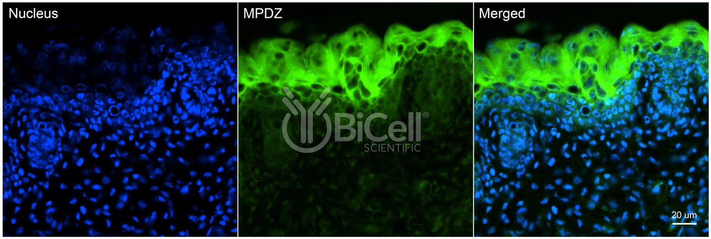 MPDZ (MUPP1) Antibody - FFPE Validated