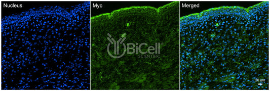 Myc (c-Myc) Antibody - FFPE Validated