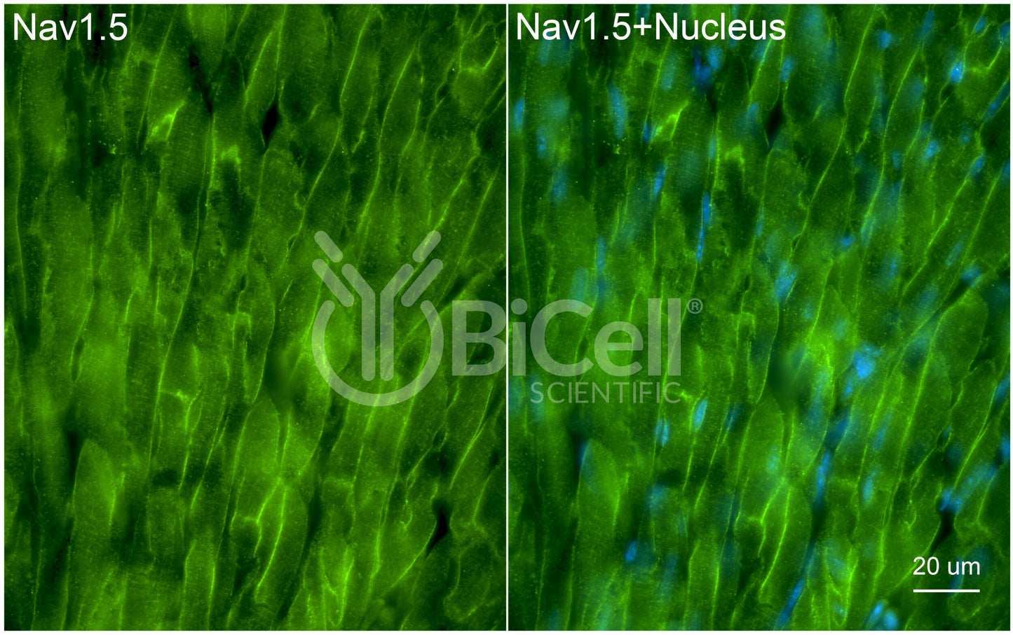 SCN5A (Nav1.5) Antibody - Western Blot Validated