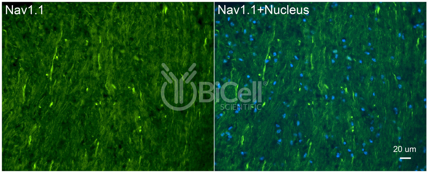 SCN1A (Nav1.1) Antibody