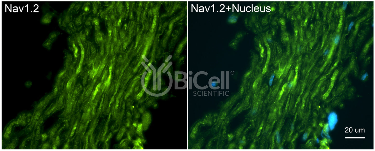 SCN2A (Nav1.2) Antibody - FFPE Validated