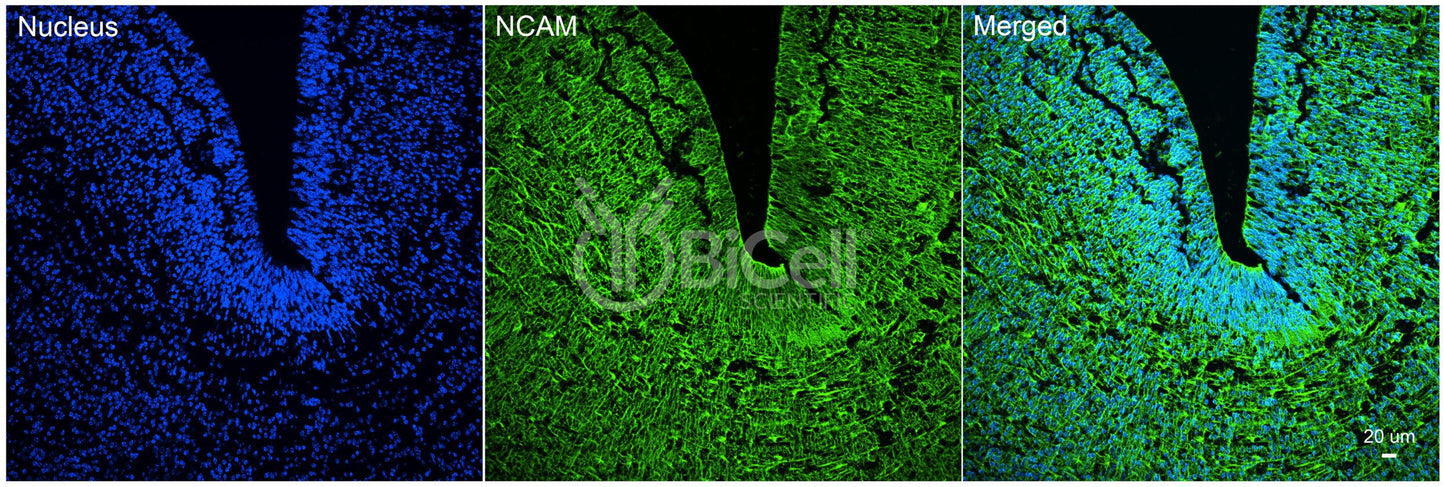 NCAM (CD56) Antibody - FFPE Validated