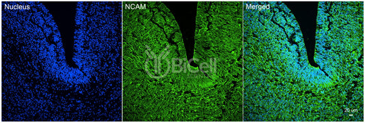 NCAM (CD56) Antibody - FFPE Validated