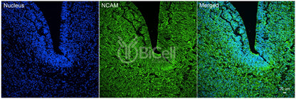 NCAM (CD56) Antibody