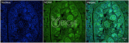 NCAM (CD56) Antibody