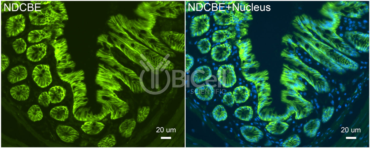NDCBE (Slc4a8) Antibody - Western Blot Validated