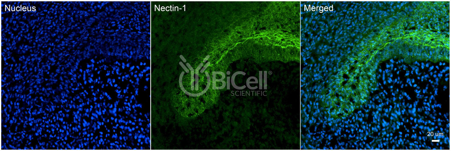 Nectin-1 (HVEC or CD111) Antibody