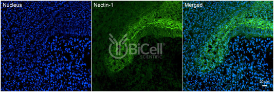 Nectin-1 (HVEC or CD111) Antibody
