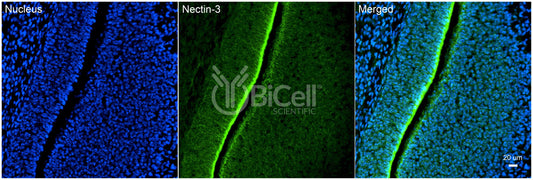 Nectin-3 (CD113) Antibody