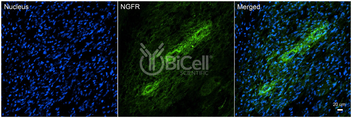 NGFR (TNFRSF16 or CD271) Antibody